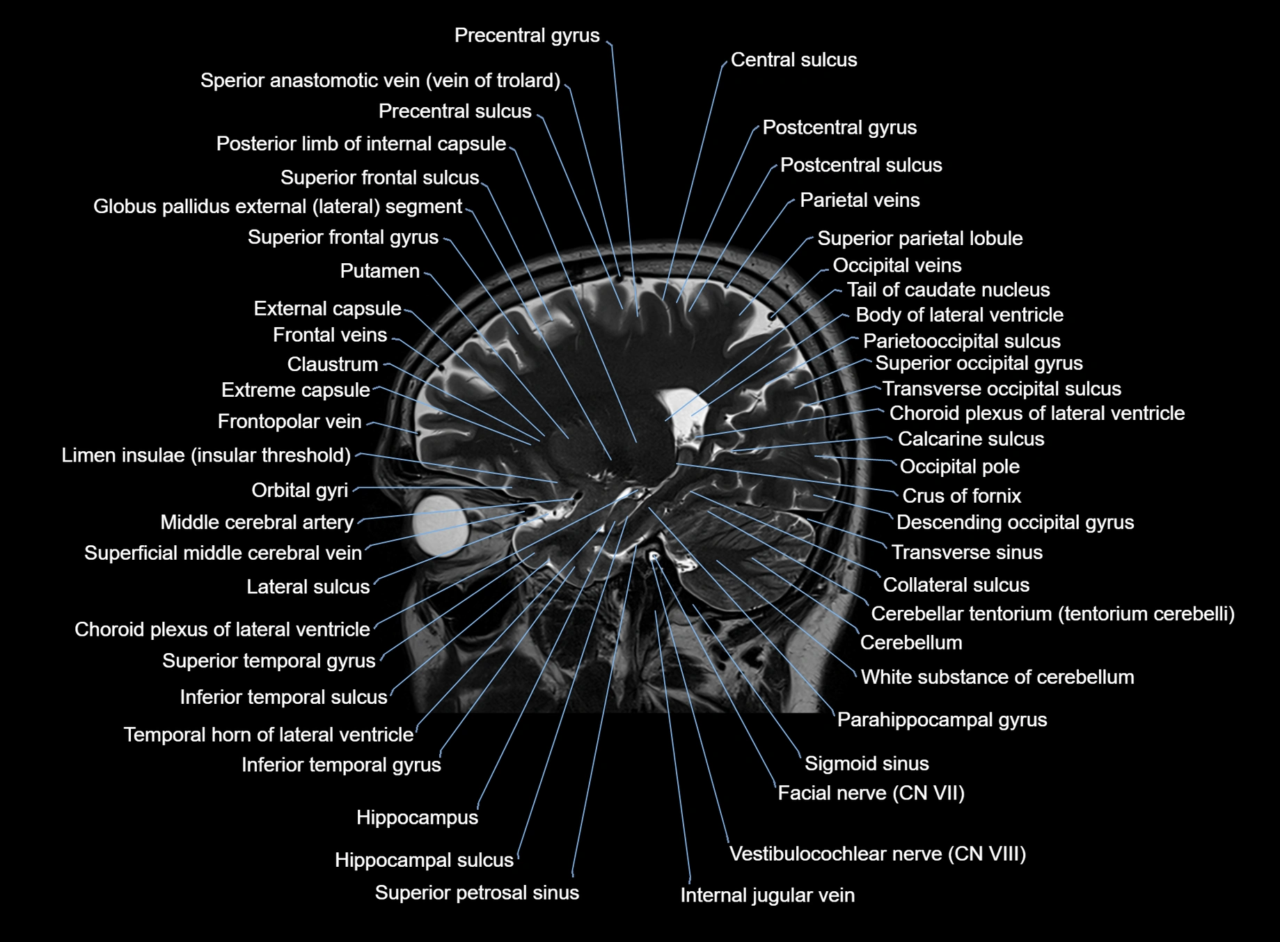 brain sagittal anatomy 3T MRI images -img-00001-00022.webp